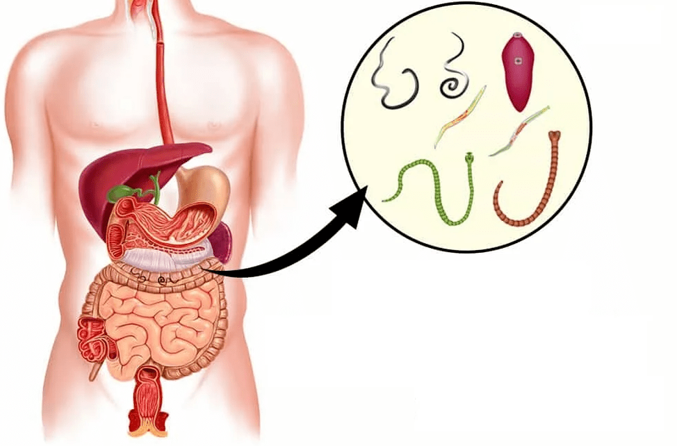 Helmintos y gusanos en el tracto gastrointestinal