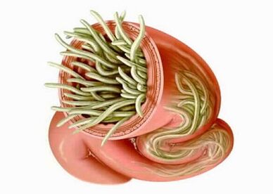Tipos de parásitos en el cuerpo humano