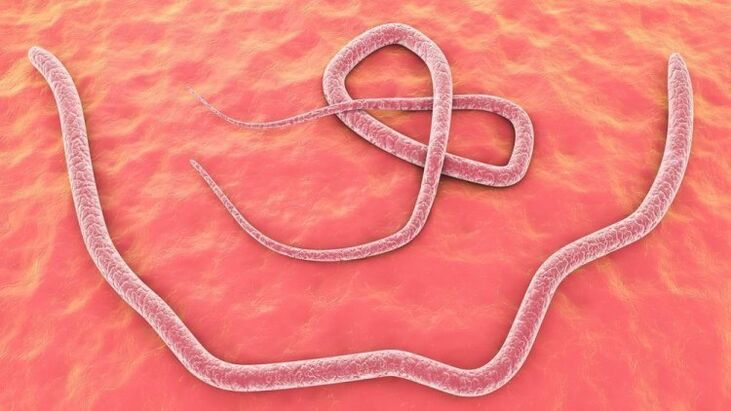 Lombrices intestinales en el cuerpo humano.