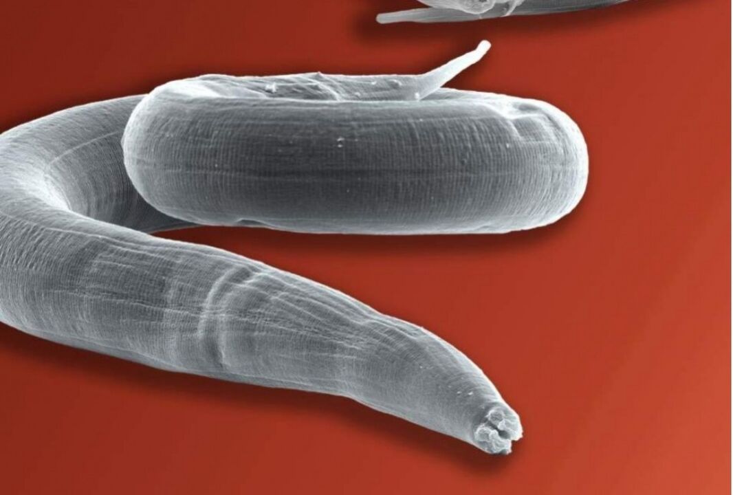 oxiuros del cuerpo humano