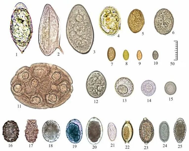 Forma y tamaño de los huevos de varios helmintos.