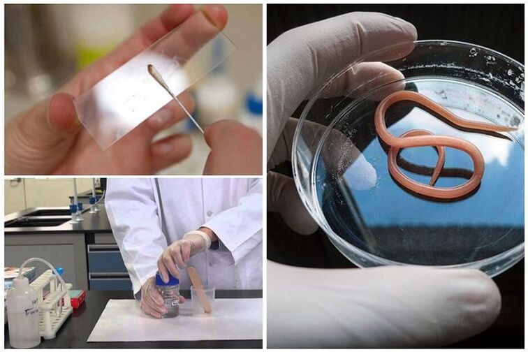 Pruebas para detectar la presencia de gusanos en el cuerpo.