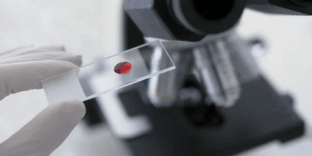 muestra de sangre
