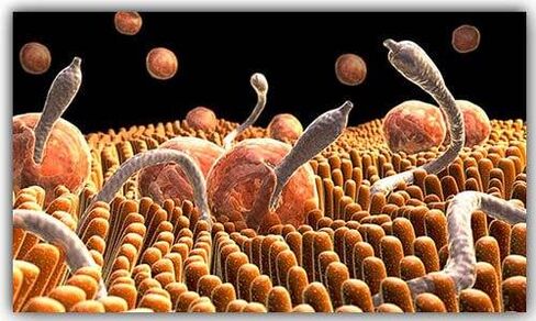 Parásitos en el cuerpo.